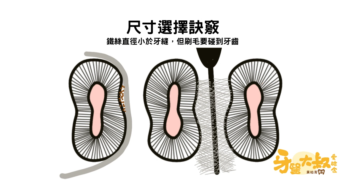 牙間刷的選擇與使用:如何選擇合適大小的牙間刷? 牙間刷的選擇與使用:如何選擇合適大小的牙間刷?