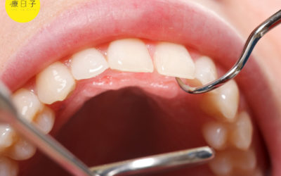 牙結石清除後會流血、牙齦敏感正常嗎？醫：更應該定期洗牙