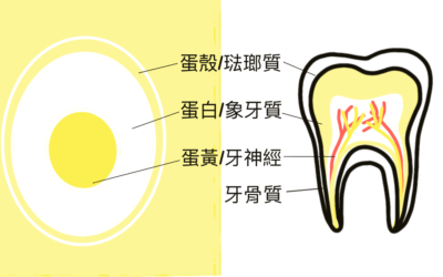 牙齒老是黃黃的，刷不乾淨還容易蛀牙？牙釉質發育不全症