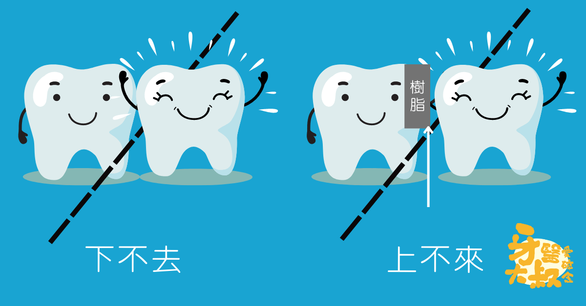 牙線為什麼卡住的原因